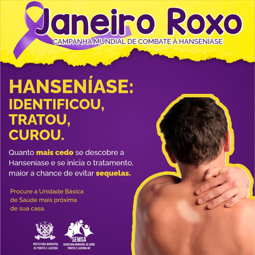 Roxos e doentes - Notícias - Dinap